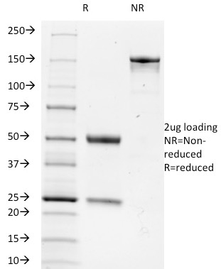 SDS-PAGE Analysis of Purified TRIM29 Monoclonal Antibody (TRIM29/1042). Confirmation of Purity and Integrity of Antibody.