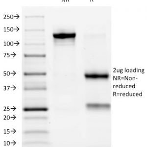 SDS-PAGE Analysis Purified ALK Mouse Monoclonal Antibody (ALK/1032). Confirmation of Purity and Integrity of Antibody.