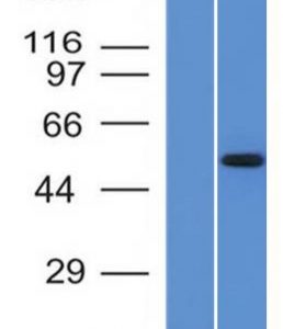Western Blot Analysis  (A) Recombinant Protein (B) HepG2 Cell lysate Using ALK-1 Monoclonal Antibody (ALK/1503).