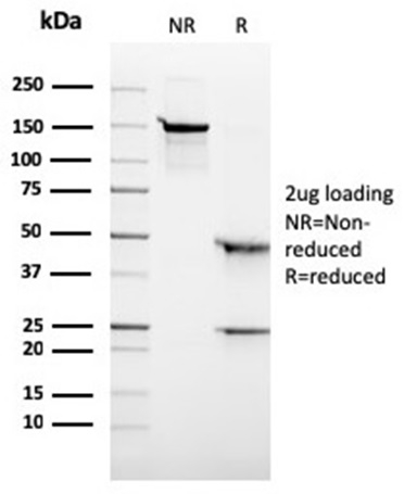 SDS-PAGE Analysis of Purified ALK-1 Recombinant Mouse Monoclonal Antibody (rALK1/1504). Confirmation of Purity and Integrity of Antibody.