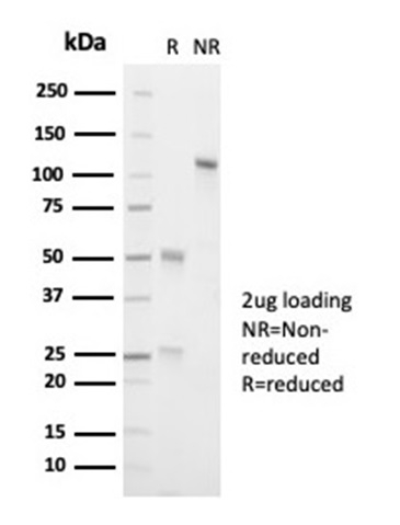 SDS-PAGE Analysis of Purified ALK1 Recombinant Rabbit Monoclonal Antibody (ALK1/7008R). Confirmation of Purity and Integrity of Antibody.