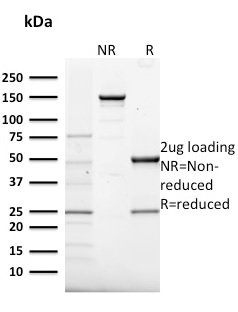 SDS-PAGE Analysis Purified Frataxin Mouse Monoclonal Antibody (FXN/2124). Confirmation of Integrity and Purity of Antibody.