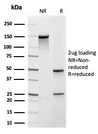 SDS-PAGE Analysis of Purified Frataxin Recombinant Mouse Monoclonal Antibody (rFXN/2124). Confirmation of Purity and Integrity of Antibody.