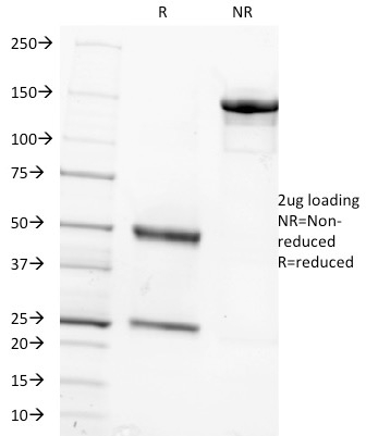 SDS-PAGE Analysis of Purified FSH beta Mouse Monoclonal Antibody (FSHb/1062). Confirmation of Integrity and Purity of Antibody.