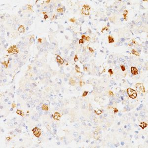 Formalin-fixed, paraffin-embedded human Pituitary stained with FSH-beta Monoclonal Antibody (SPM107).