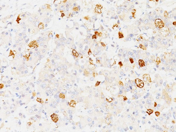 Formalin-fixed, paraffin-embedded human Pituitary stained with FSH-beta Monoclonal Antibody (SPM107).
