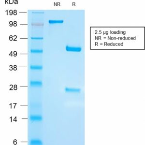 SDS-PAGE Analysis of Purified FSH beta Recombinant Rabbit Monoclonal Antibody (FSHb/2033R). Confirmation of Integrity and Purity of the Antibody.