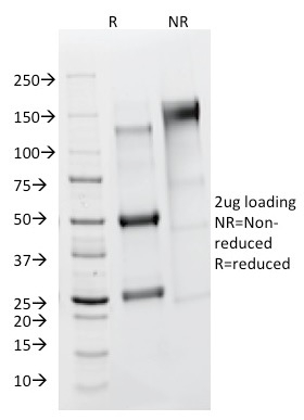 SDS-PAGE Analysis of Purified FSH Receptor Mouse Monoclonal Antibody (FSHR/1400). Confirmation of Purity and Integrity of Antibody.