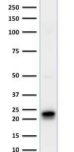 Western Blot of HeLa, cell lysate using Ferritin, Heavy Chain Mouse Monoclonal Antibody (FTH/2081).