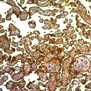 Formalin-fixed, paraffin-embedded human Placenta stained with PLAP Monoclonal Antibody (SPM593).