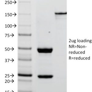 SDS-PAGE Analysis of Purified PLAP Mouse Monoclonal Antibody (ALPP/238). Confirmation of Integrity and Purity of Antibody.