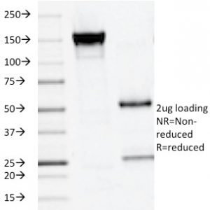 SDS-PAGE Analysis of Purified PLAP Mouse Monoclonal Antibody (ALPP/516). Confirmation of Integrity and Purity of Antibody.