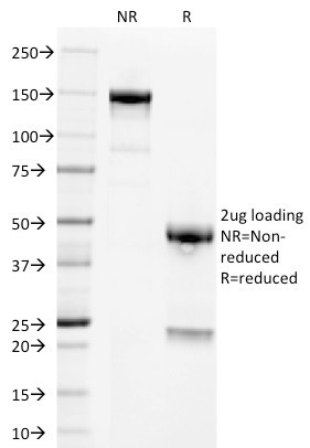 SDS-PAGE Analysis of Purified PLAP Mouse Monoclonal Antibody (GM022).