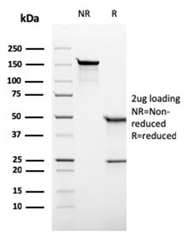 SDS-PAGE Analysis Purified Alkaline Phosphatase Recombinant Mouse Monoclonal (rALP/870). Confirmation of Purity and Integrity of Antibody.