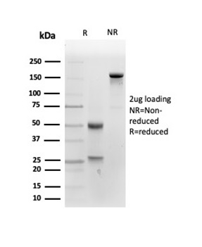 SDS-PAGE Analysis of Purified PLAP Mouse Monoclonal Antibody (ALPP/4109). Confirmation of Integrity and Purity of Antibody.