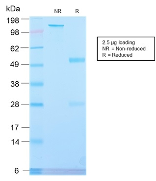 SDS-PAGE Analysis Purified PLAP Rabbit Recombinant Monoclonal Antibody (ALPP/2899R). Confirmation of Integrity and Purity of Antibody.