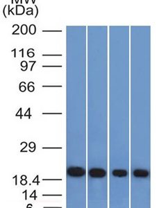 Western Blot of A431, HeLa, Liver and Testis lysate using Ferritin, Light Chain Mouse Monoclonal Antibody (FTL/1386).