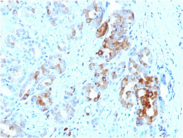 Formalin-fixed, paraffin-embedded human Prostate stained with Ferritin, Light Chain Mouse Monoclonal Antibody (FTL/1387).