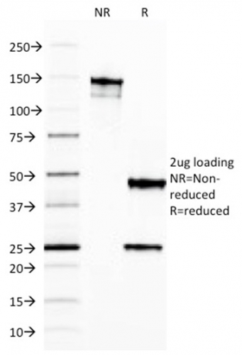 SDS-PAGE Analysis Purified Ferritin, Light Chain Mouse Monoclonal Antibody (FTL/1387). Confirmation of Integrity and Purity of Antibody