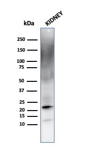 Western Blot Analysis of human kidney cell lysate using Ferritin, Light Chain Mouse Monoclonal Antibody (FTL/1387).