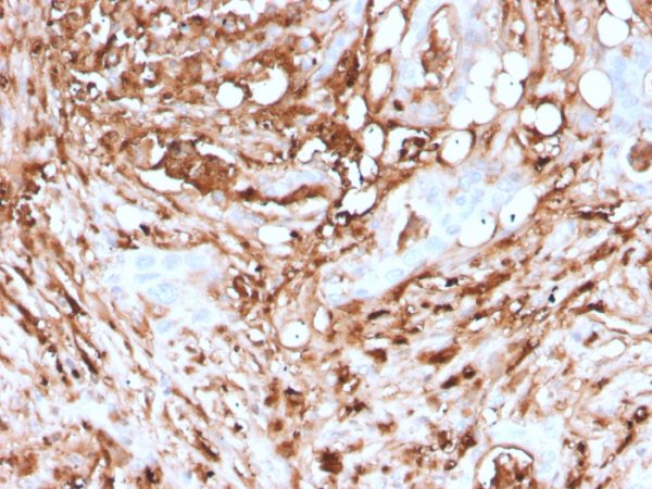 Formalin-fixed, paraffin-embedded human Pancreas stained with Ferritin, Light Chain Recombinant Mouse Monoclonal Antibody (rFTL/1388).