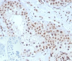 Formalin-fixed, paraffin-embedded human testis stained with SF-1 Mouse Monoclonal Antibody (NR5A1/3420) at 2ug/ml. Inset: PBS instead of primary antibody; secondary only negative control.
