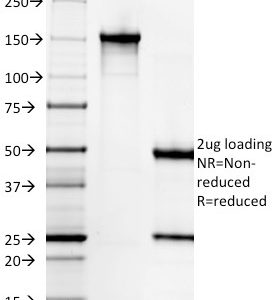 SDS-PAGE Analysis of Purified Gastrin Mouse Monoclonal Antibody (GAST/2631). Confirmation of Integrity and Purity of Antibody.