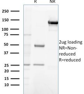 SDS-PAGE Analysis of Purified Gastrin Mouse Monoclonal Antibody (GAST/2632). Confirmation of Purity and Integrity of Antibody.