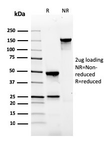 SDS-PAGE Analysis of Purified Gastrin Mouse Monoclonal Antibody (GAST/2634). Confirmation of Integrity and Purity of Antibody.