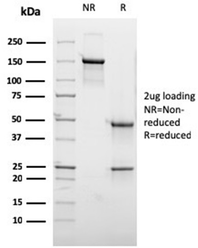 SDS-PAGE Analysis of Purified HGAL Mouse Monoclonal Antibody (HGAL/2373). Confirmation of Purity and Integrity of Antibody.