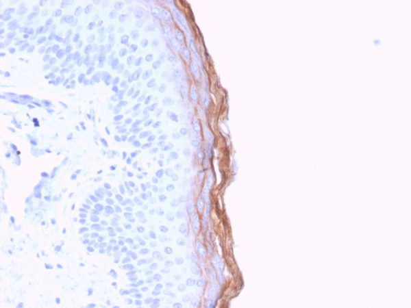 Formalin-fixed, paraffin-embedded human skin stained with Kallikrein 5 Mouse Monoclonal Antibody (KLK5/3841).