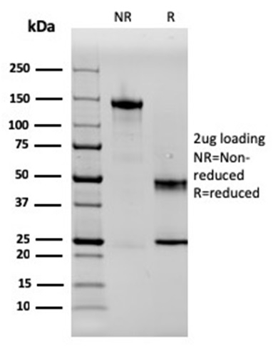 SDS-PAGE Analysis Purified SERBP1 Mouse Monoclonal Antibody (SERBP1/3497). Confirmation of Purity and Integrity of Antibody.