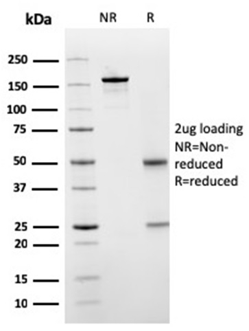 SDS-PAGE Analysis Purified SERBP1 Mouse Monoclonal Antibody (SERBP1/3498). Confirmation of Purity and Integrity of Antibody.