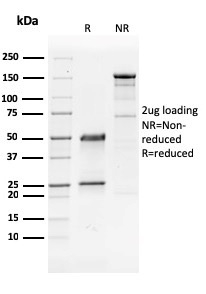 SDS-PAGE Analysis of Purified GATA-3 Mouse Monoclonal Antibody (GATA3/2441). Confirmation of Purity and Integrity of Antibody.