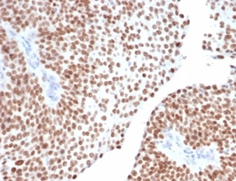 Formalin-fixed, paraffin-embedded human bladder stained with GATA-3 Mouse Monoclonal Antibody (GATA3/6664).