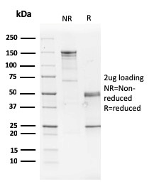 SDS-PAGE Analysis of Purified GATA-3 Mouse Monoclonal Antibody (GATA3/2442). Confirmation of Purity and Integrity of Antibody.