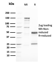 SDS-PAGE Analysis of Purified GATA-3 Mouse Monoclonal Antibody (GATA3/2446). Confirmation of Purity and Integrity of Antibody.