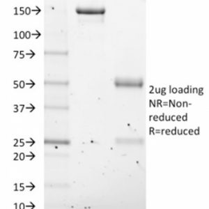 SDS-PAGE Analysis of Purified NKX2.8 Mouse Monoclonal Antibody (NKX28/2547). Confirmation of Purity and Integrity of Antibody.