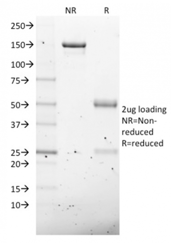 SDS-PAGE Analysis of Purified NKX2.8 Mouse Monoclonal Antibody (NKX28/2547). Confirmation of Purity and Integrity of Antibody.