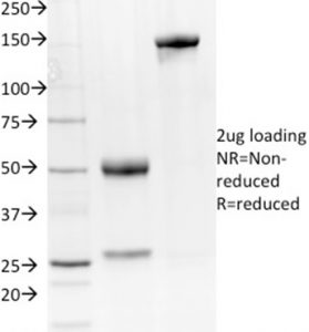 SDS-PAGE Analysis of Purified NKX2.8 Mouse Monoclonal Antibody (NKX28/2548). Confirmation of Integrity and Purity of Antibody.