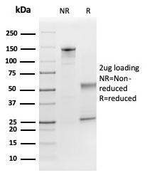 SDS-PAGE Analysis of Purified FGF21 Mouse Monoclonal antibody (FGF21/3691). Confirmation of Purity and Integrity of Antibody.