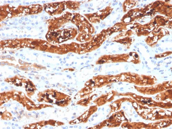 Formalin-fixed, paraffin-embedded human kidney stained with FGF21 Mouse Monoclonal antibody (FGF21/3691).