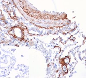Formalin-fixed, paraffin-embedded human lung stained with FGF21 Mouse Monoclonal antibody (FGF21/4343). Inset: PBS instead of primary antibody; secondary only negative control.