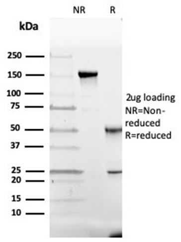 SDS-PAGE Analysis of Purified GC Mouse Monoclonal Antibody (VDBP/4482). Confirmation of Purity and Integrity of Antibody.