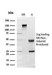 SDS-PAGE Analysis of Purified GDF8 / Myostatin Mouse Monoclonal Antibody (MSTN/4254) Confirmation of Integrity and Purity of Antibody.
