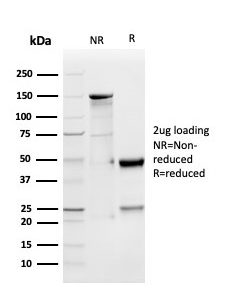 SDS-PAGE Analysis of Purified GDF9 Rat Monoclonal Antibody (GDF9/4262) Confirmation of Integrity and Purity of Antibody.