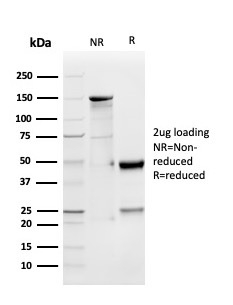 SDS-PAGE Analysis of Purified GDF9 Rat Monoclonal Antibody (GDF9/4262) Confirmation of Integrity and Purity of Antibody.