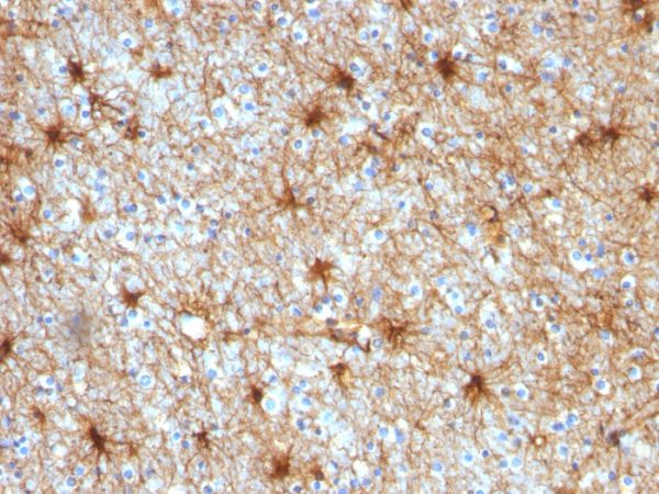 Formalin-fixed, paraffin-embedded human Cerebellum stained with GFAP Mouse Monoclonal Antibody (GA-5).
