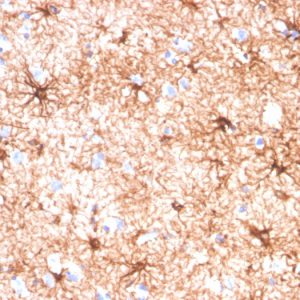 Formalin-fixed, paraffin-embedded human cerebellum stained with GFAP Mouse Monoclonal Antibody (GFAP/4450).