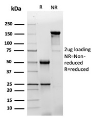 SDS-PAGE Analysis Purified GFAP Mouse Monoclonal Antibody (GFAP/4450). Confirmation of Purity and Integrity of Antibody.